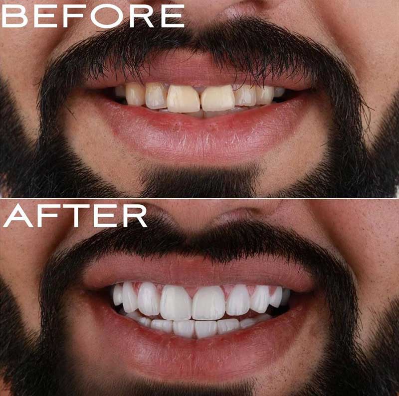 Gallery Kaplan Dental Lab Dubai