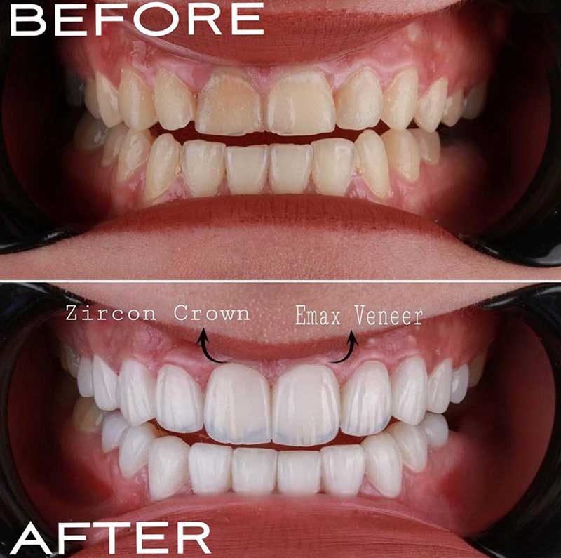 Gallery Kaplan Dental Lab Dubai