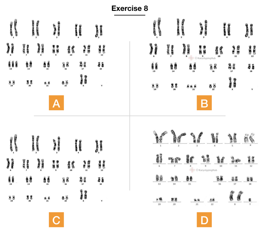10 best karyotyping activities and assignments KaryotypingHub