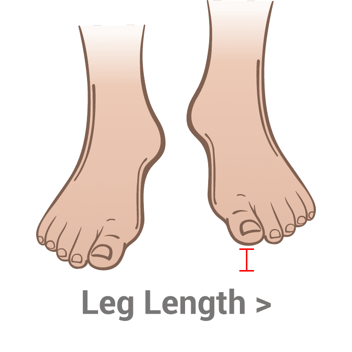 Leg Length Kassis Brother's Shoes