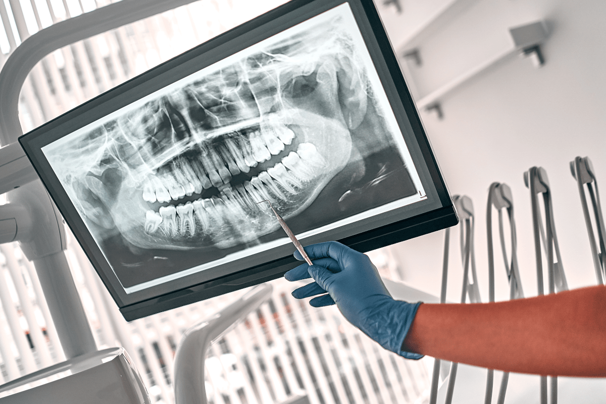 Dental Xray Dental Services Dentist in Sofia, Bulgaria