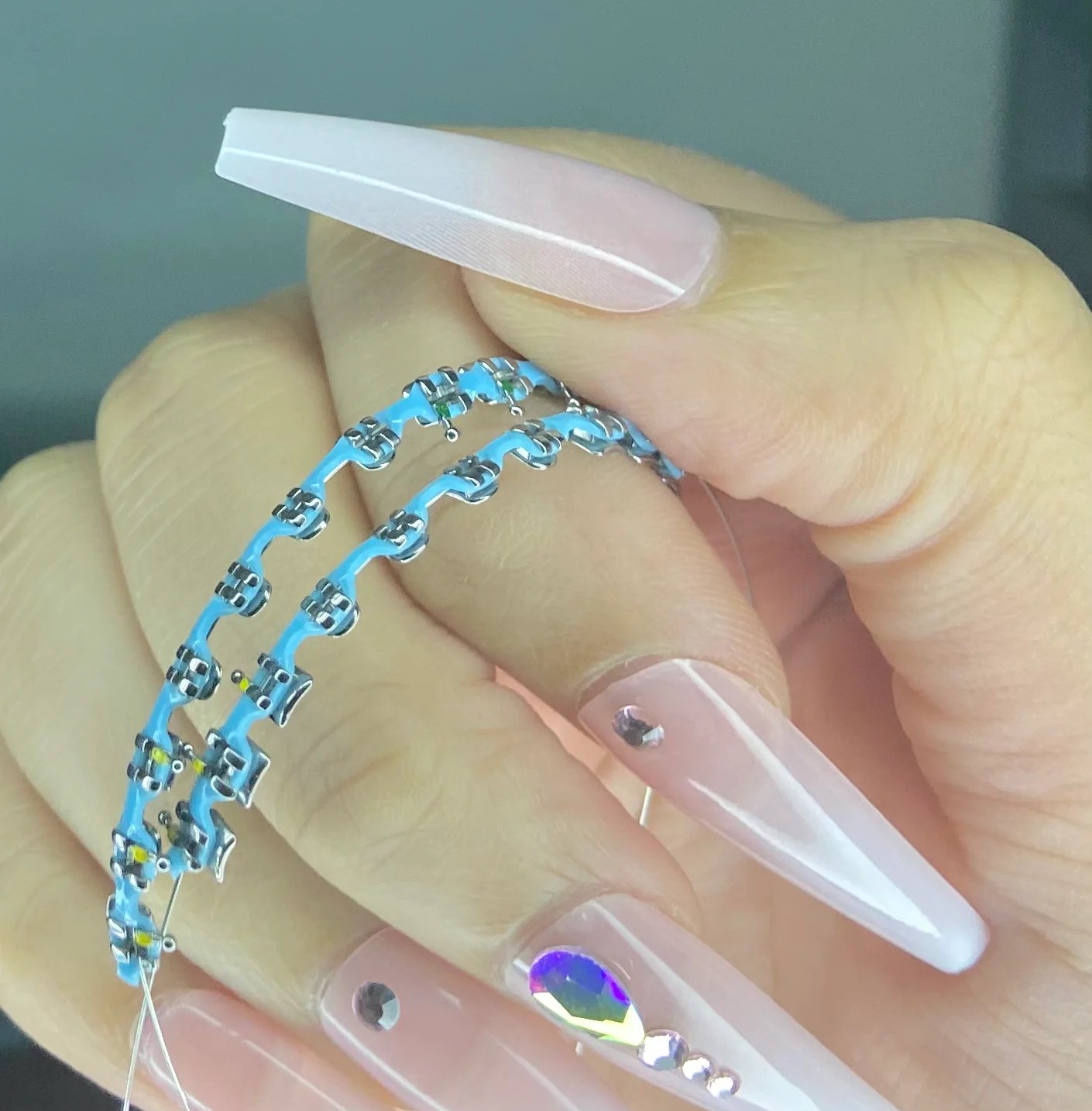 Customizable Power Chain Braces (CHOOSE YOUR OWN COLOR) kawaiibraces