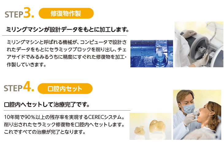かわもり歯科/セレックシステム