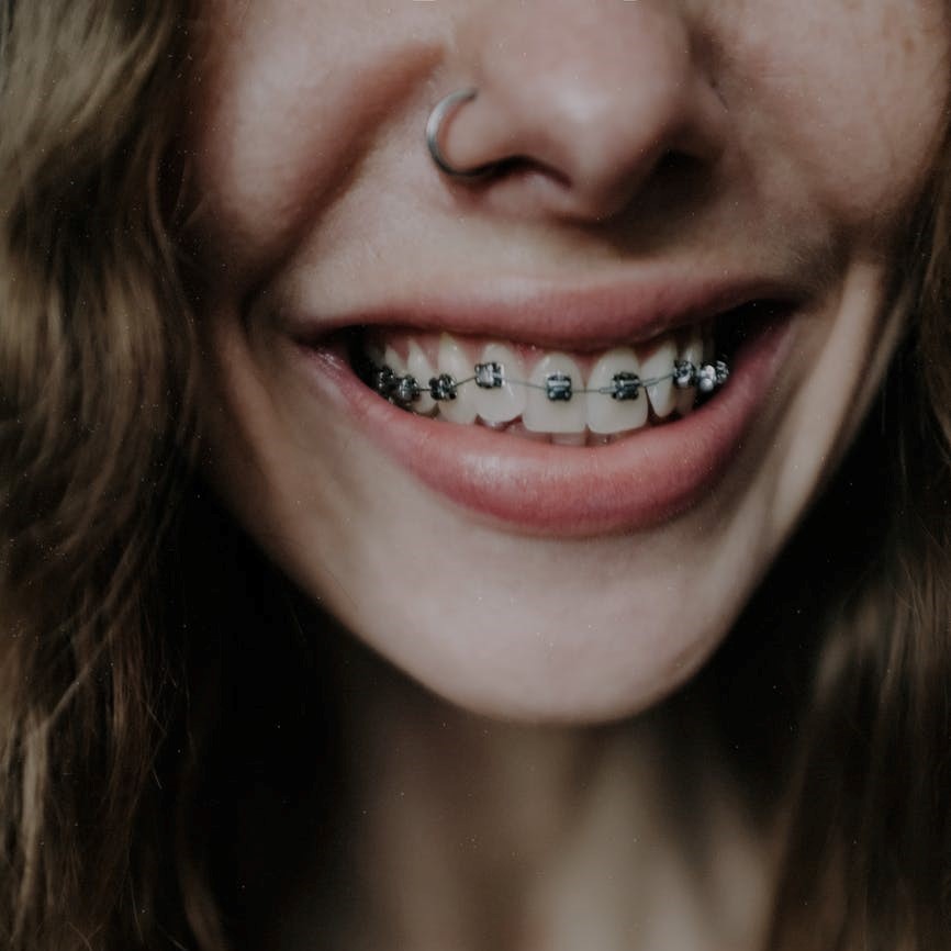 How to Solve Braces Problems at Home Katy ClearChoice Orthodontics