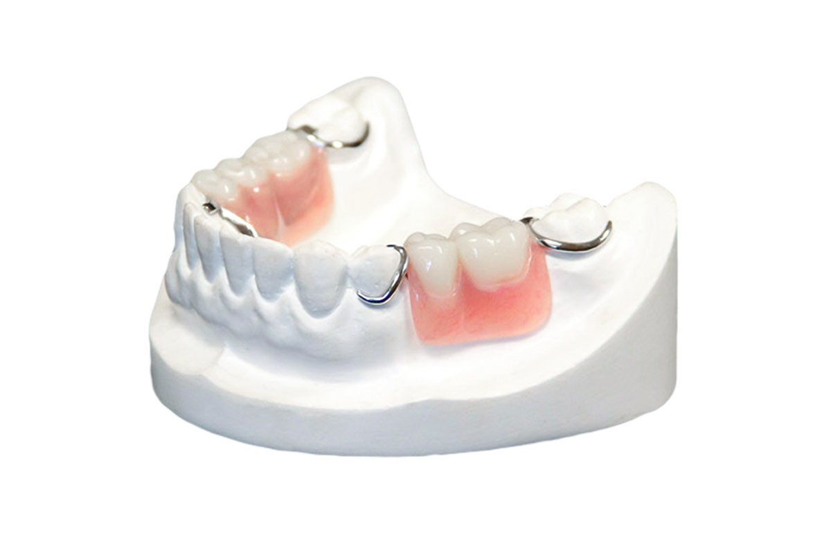 Products & Services K&C Denture Center