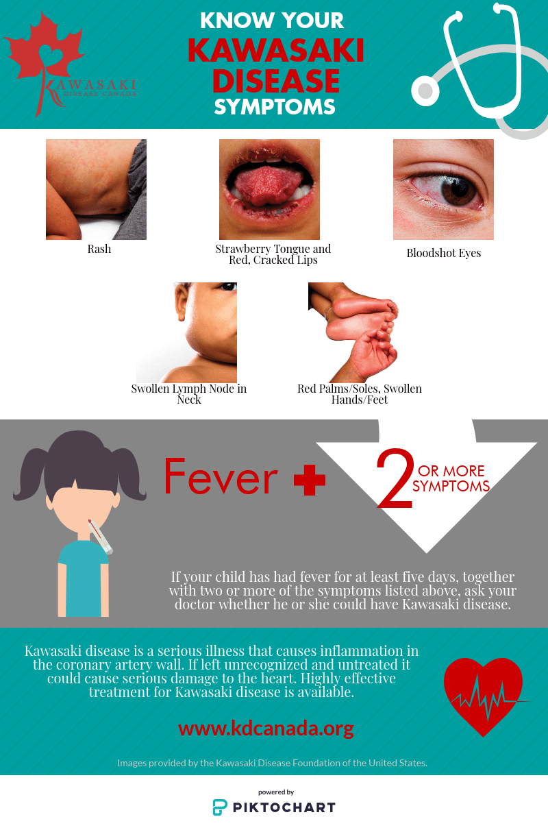 Kawasaki disease FaieFreddie