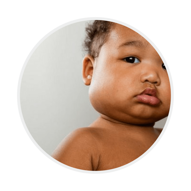 KD Symptoms Kawasaki Disease Foundation