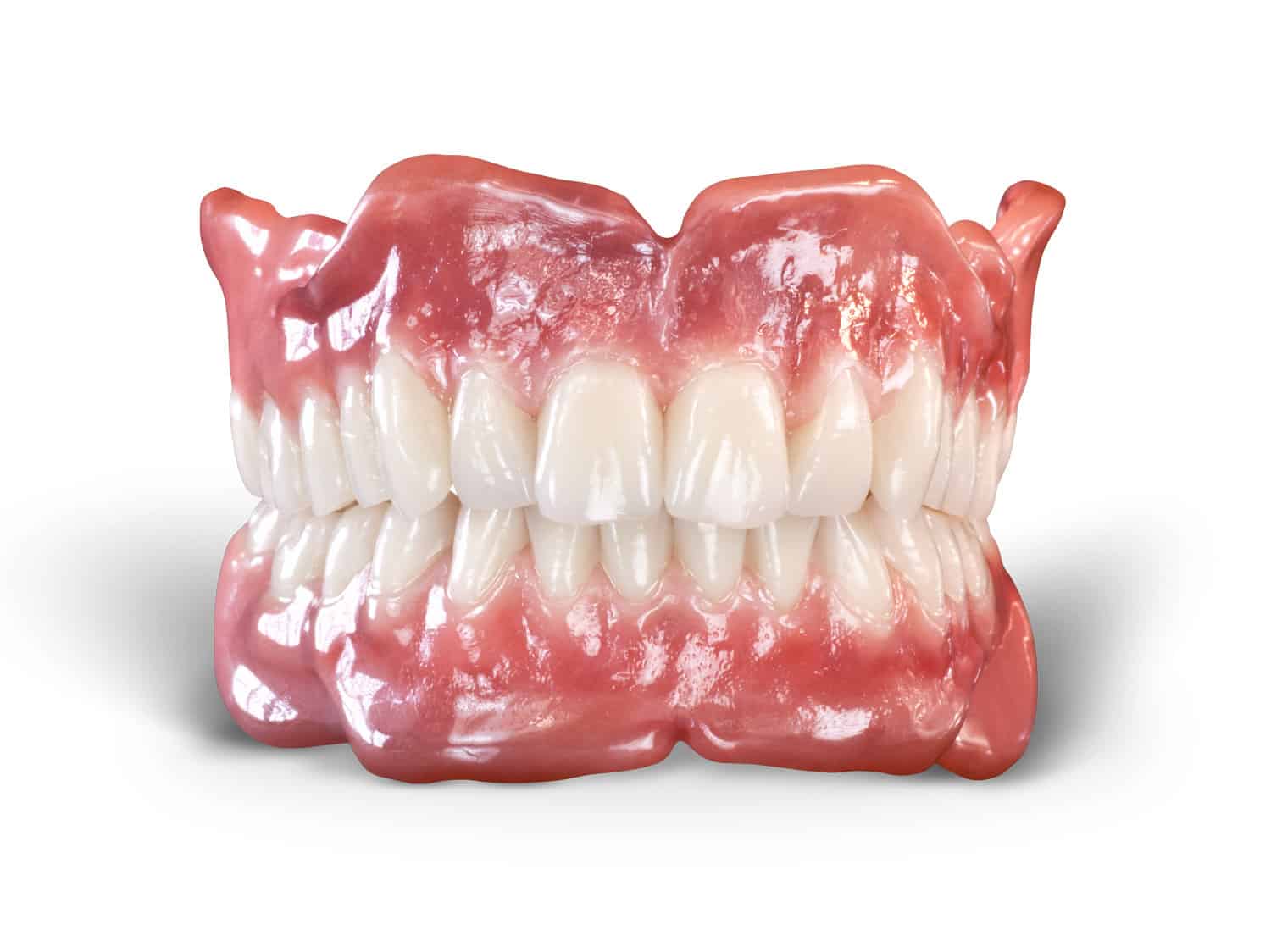 Removables Removable Denture Implants Keating Dental Lab