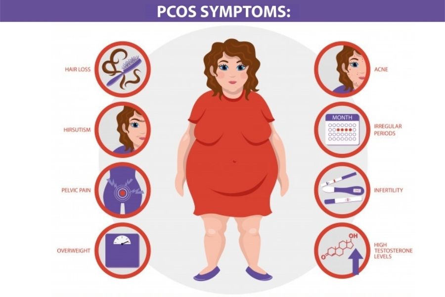 Apa Itu Pcos Dan Cara Mengatasinya