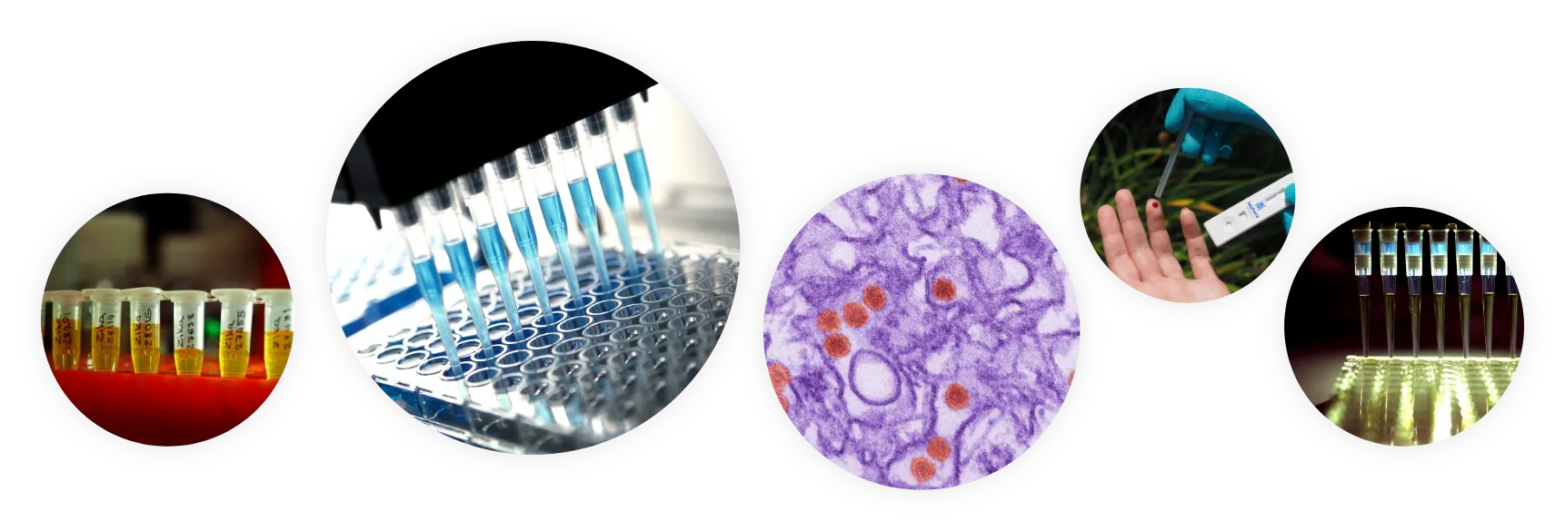 Kephera Diagnostics CLIACertified Lab Testing for Infectious Disease