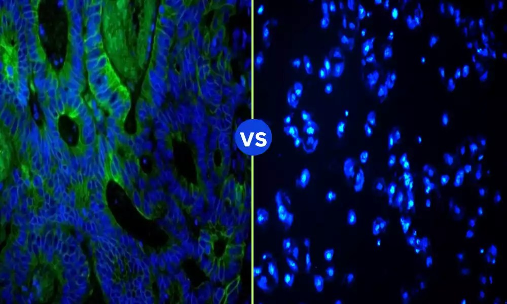 Best 7 Difference Between DAPI and Hoechst