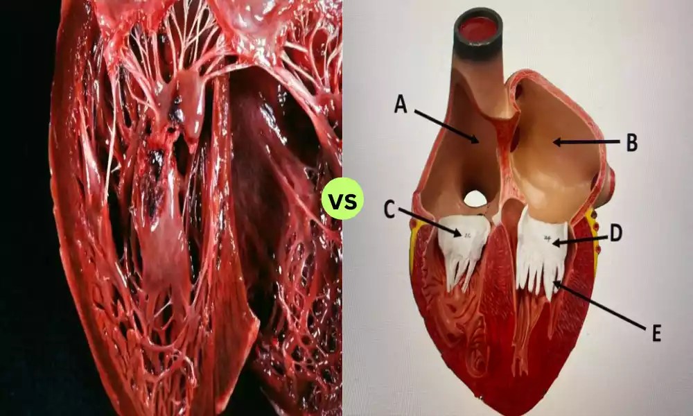What is the Difference Between Papillary and Pectinate Muscles Key