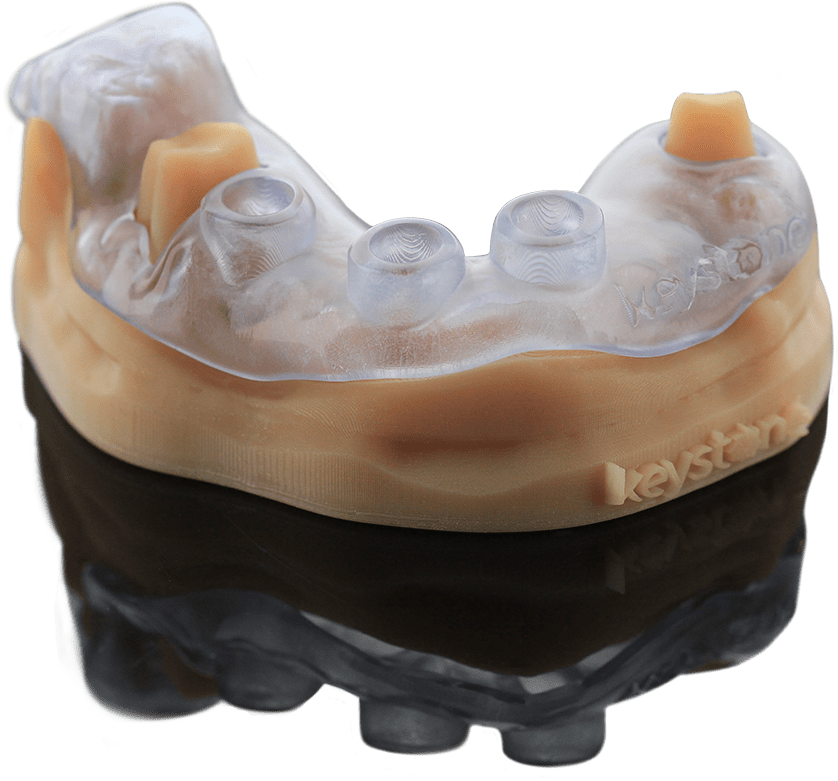 KeyPrint Precision 3D Dental Resins