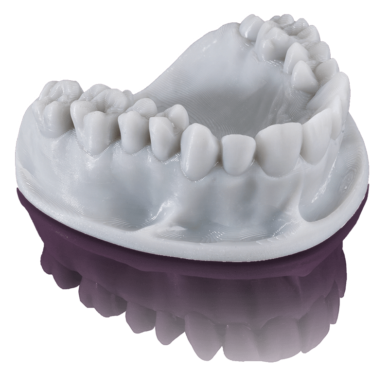 KeyPrint Precision 3D Dental Resins