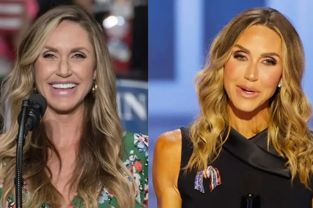 Lara Trump Before And After Cosmetic Surgery A Makeover