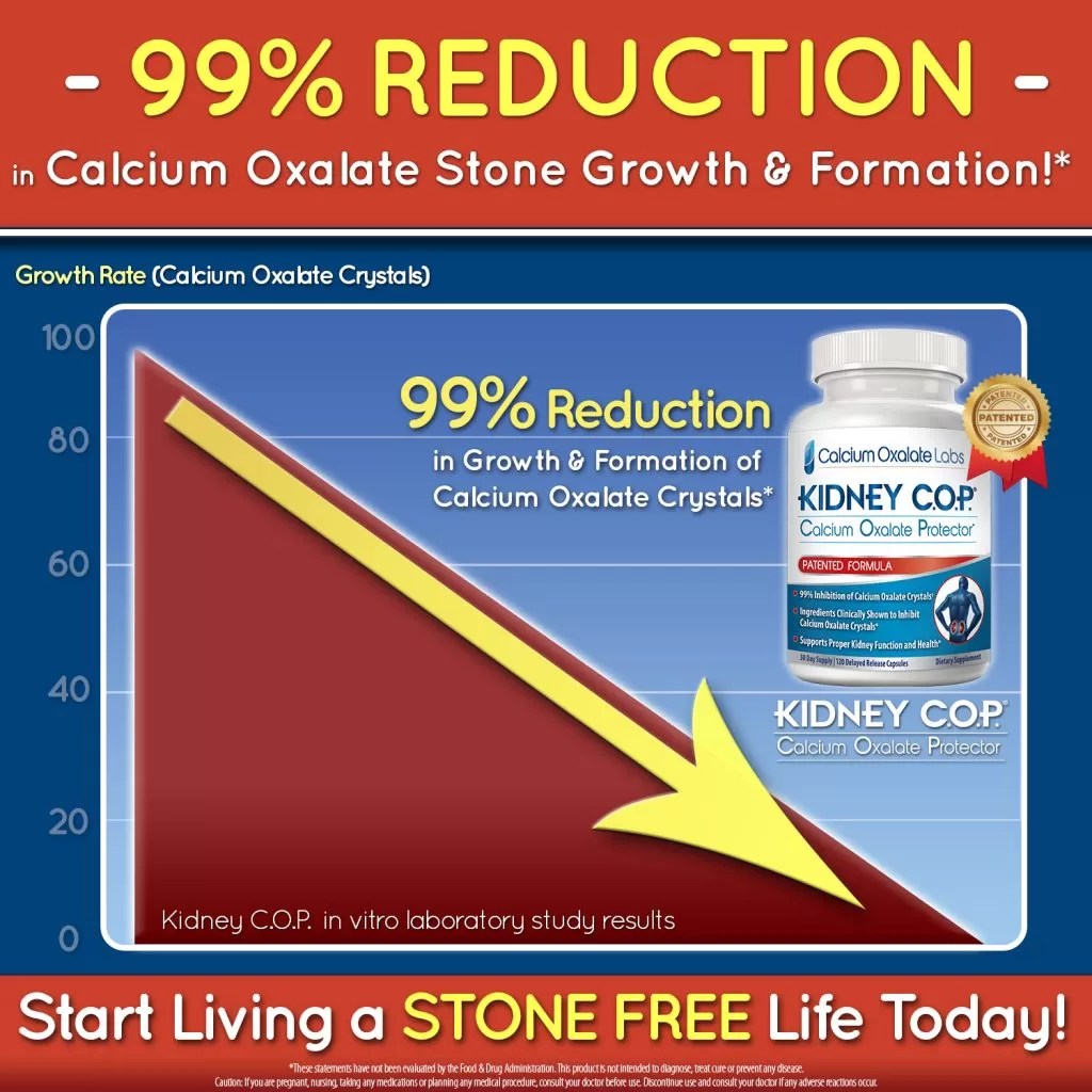 Calcium oxalate stone reduction by 99 kidneycop