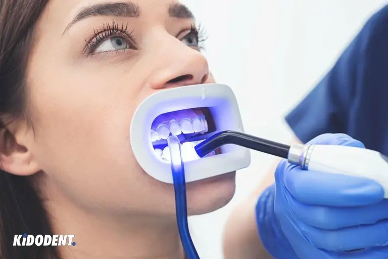 Professional Teeth Whitening Cost, Benefits, Procedure & Kits