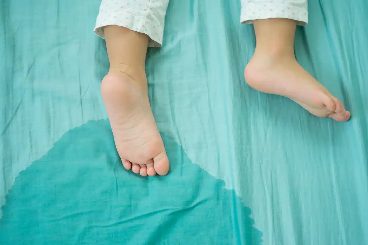 Enuresis in Children Why Matter When Treating Children Who