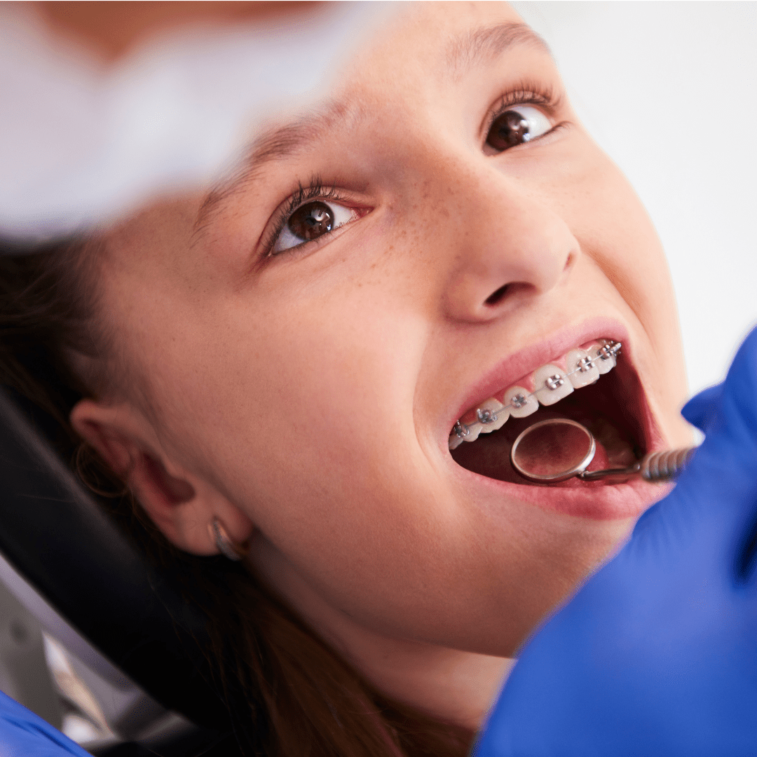 Addressing Early Childhood Caries A Comprehensive Local Approach