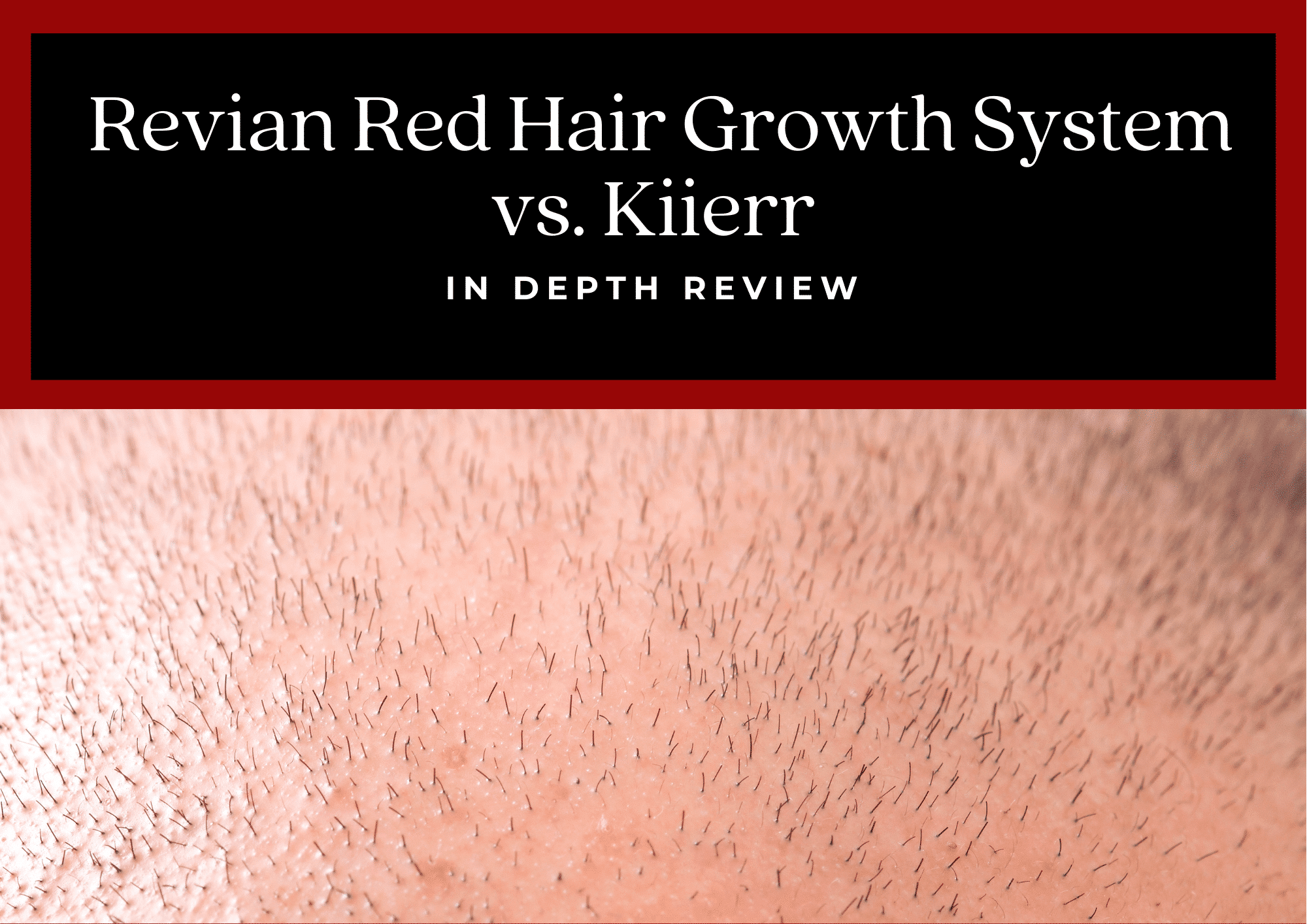 Revian Red Hair Growth System Review vs Kiierr 2023 Guide