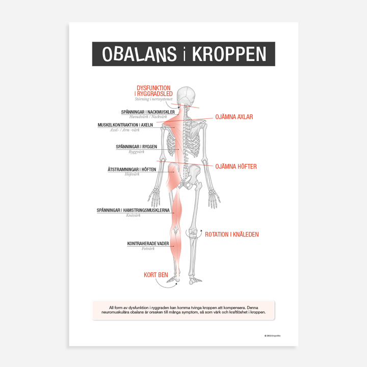 OBALANS i KROPPEN Kiropraktikaffisch Kirografiks