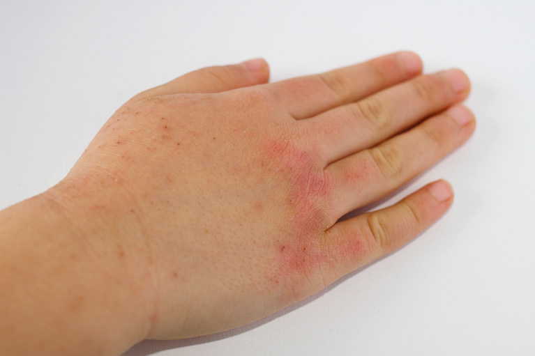 藤枝市で幅広く診療しています｜きたむら皮フ科クリニック