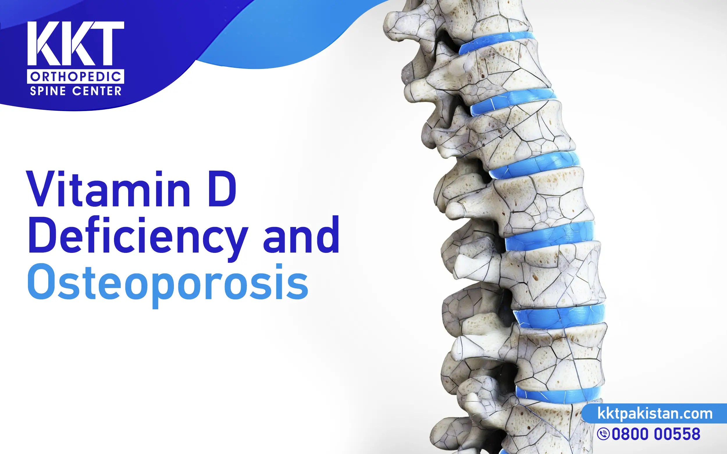 Vitamin D Deficiency and Osteoporosis KKT Pakistan Pakistan's Only