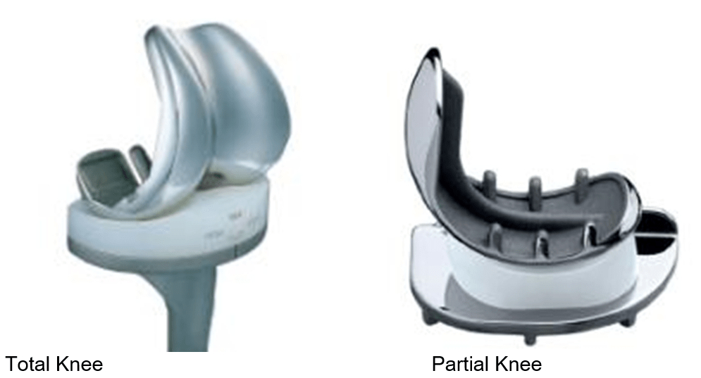 Knee Replacement Implants