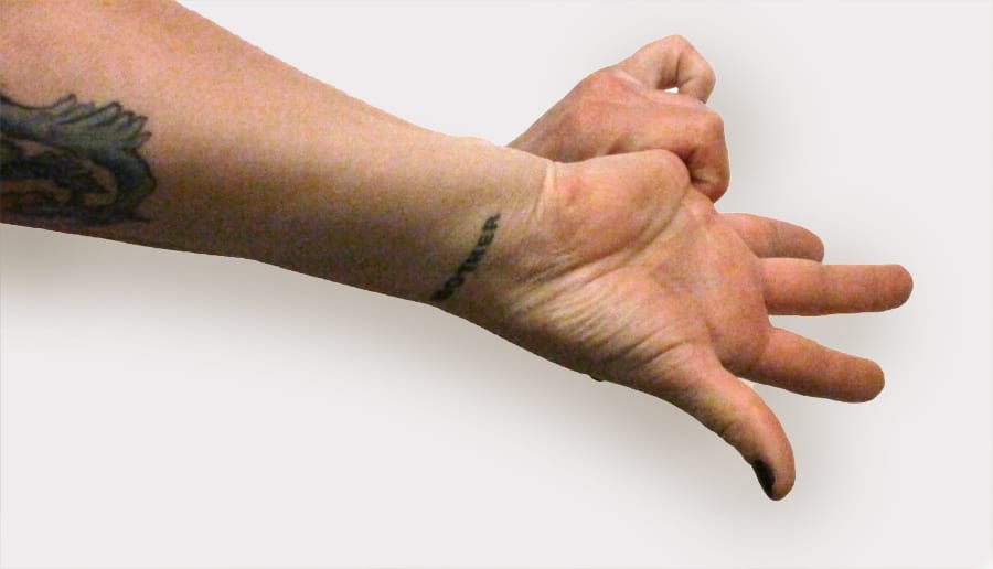 Ring finger knuckle pain Beliebtester Schmuck
