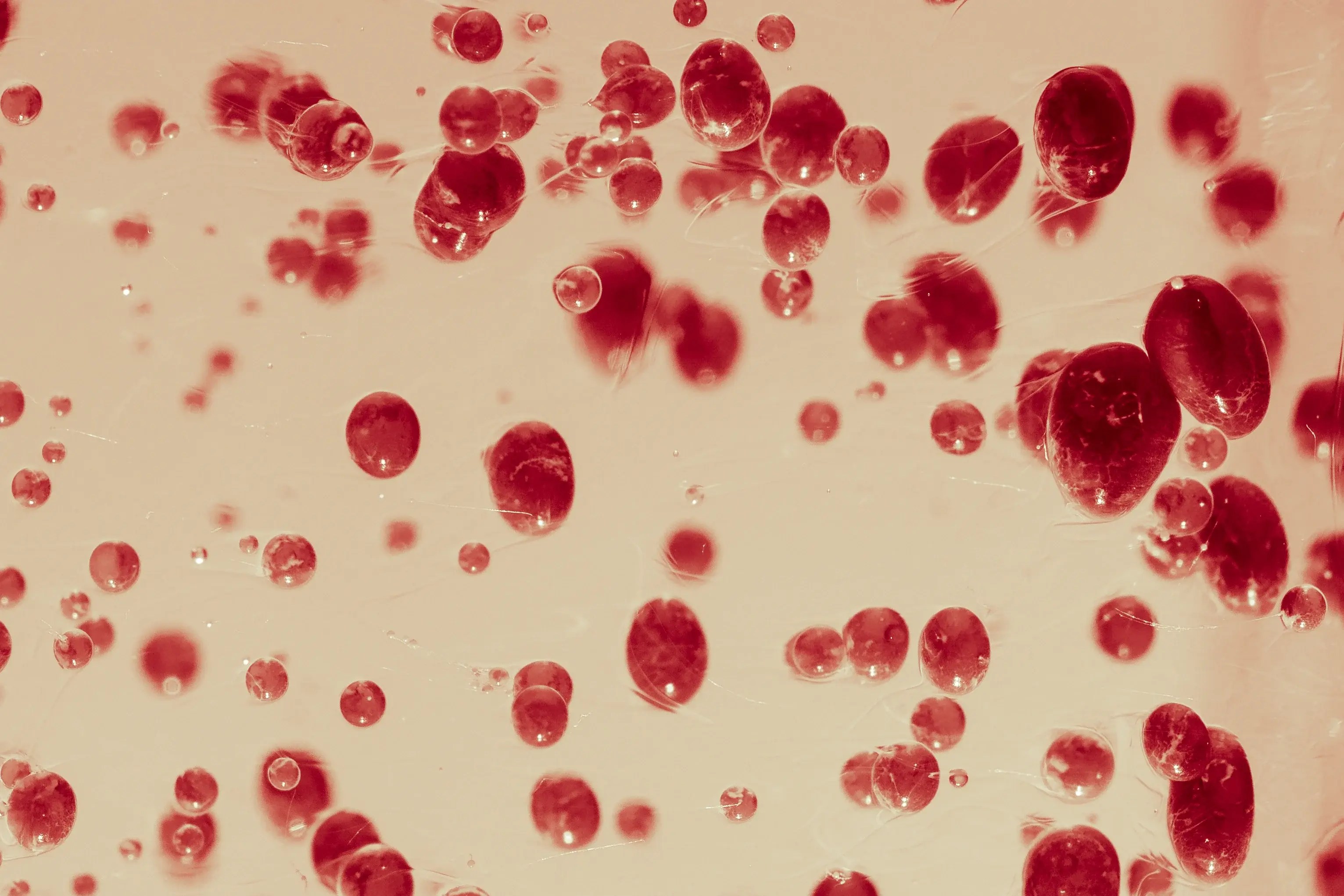 Descubre todo sobre el Ureaplasma (U. parvum y U. urealyticum) causas