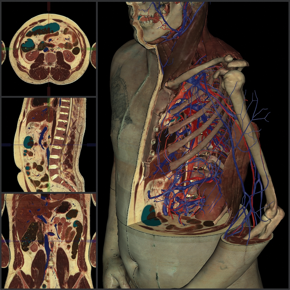 Take Your Anatomy Labs Online