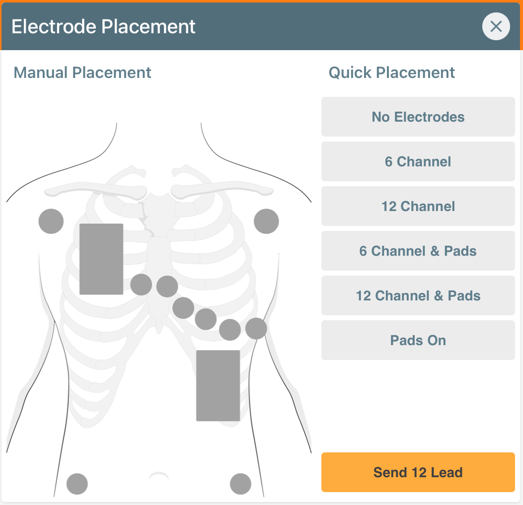 Contrôleur Section 1 Placement des électrodes ECG et des patchs de défibrillation iSimulate