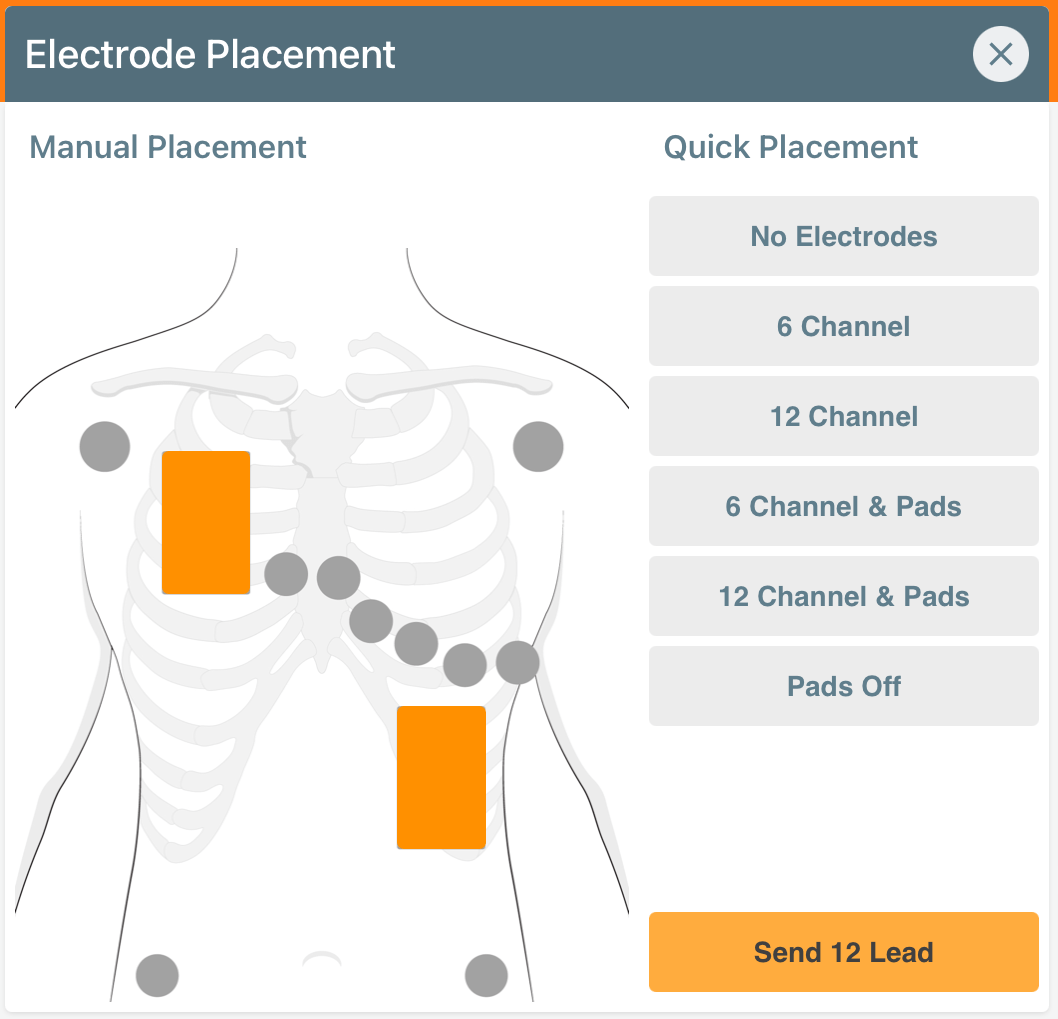 Contrôleur Section 1 Placement des électrodes ECG et des patchs de