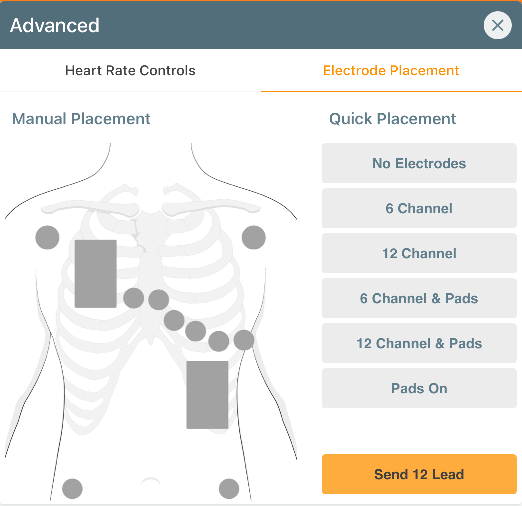 Control Section 2 Heart Rate and ECG Control iSimulate
