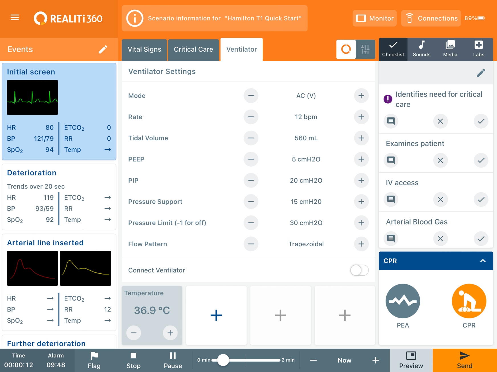 Control - Section 2: Ventilator Controls – iSimulate