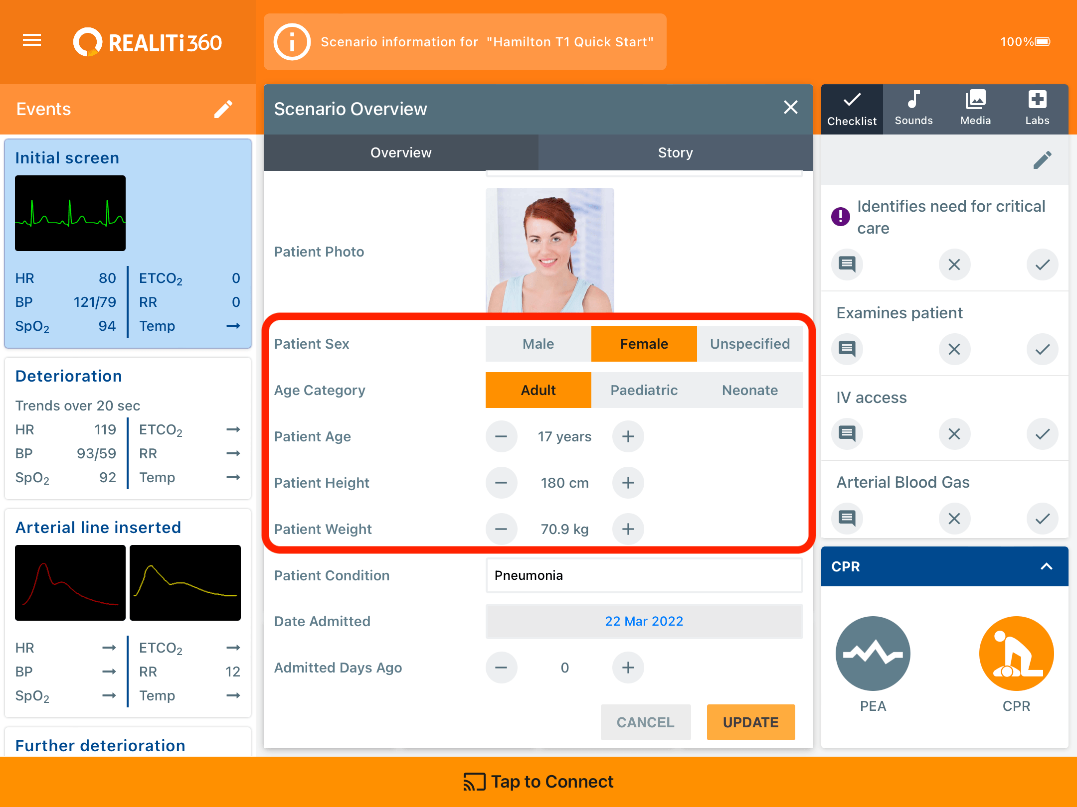 Control - Section 2: Ventilator Controls – iSimulate