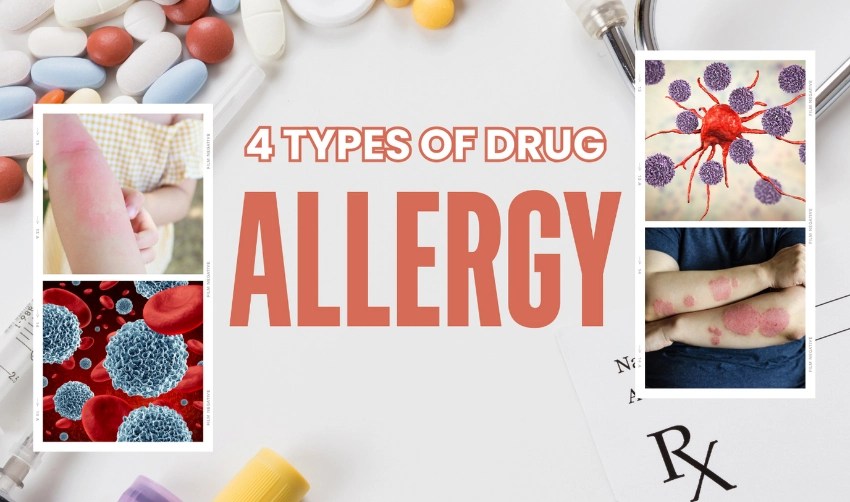 Drug Allergy Defined From Signs to Solutions KnowlesWellness