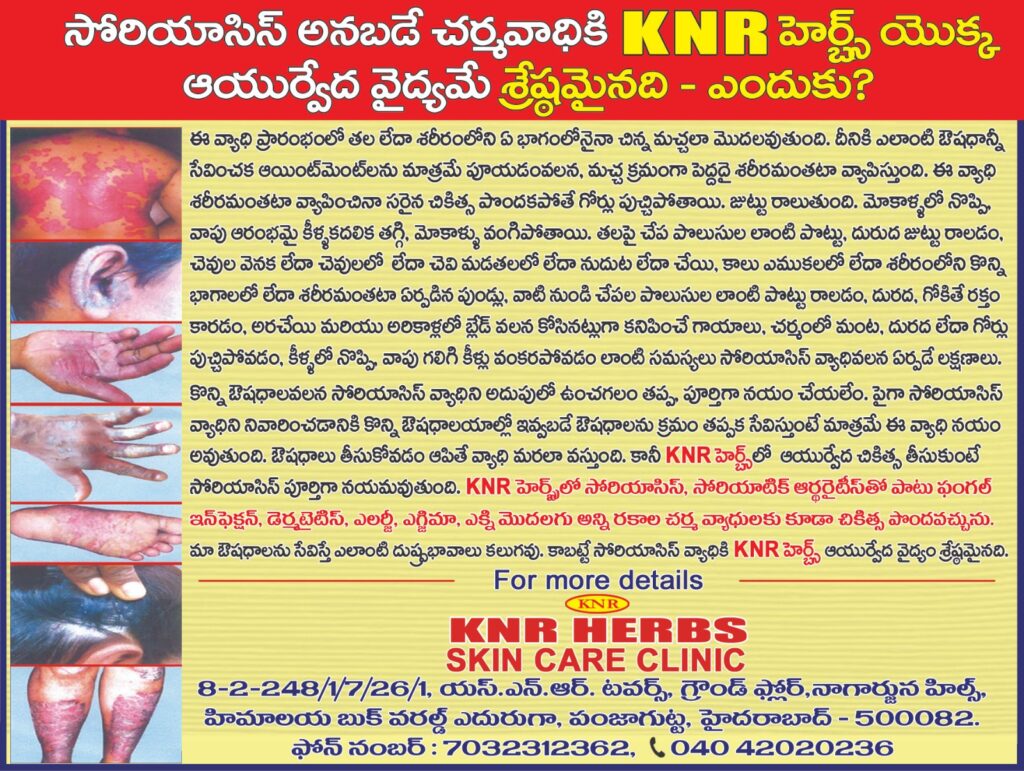 Blogs of KNR Herbs KNR Herbs skin care Center Best Ayurvedic