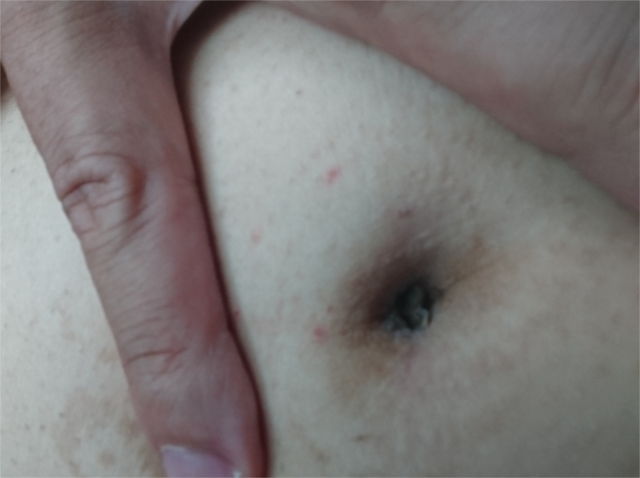 夢占い】おへそが印象に残る夢の意味や心理10選 | 心理学ラボ 生まれて初めてのへそのゴマ掃除 | こんぷれ