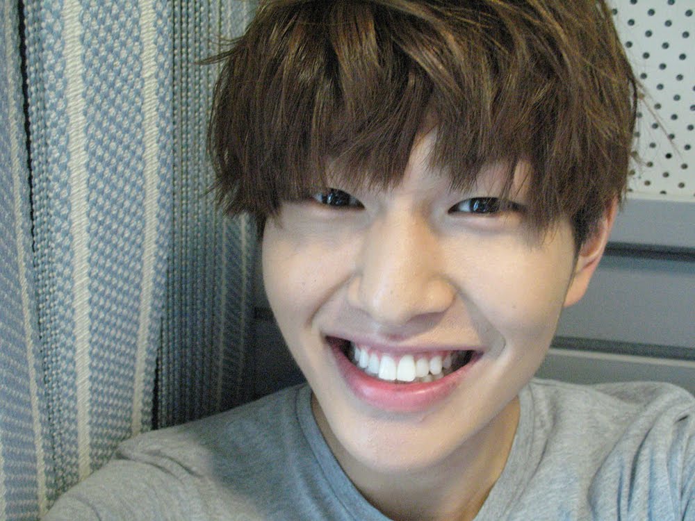 Do Kpop Idols Have Veneers