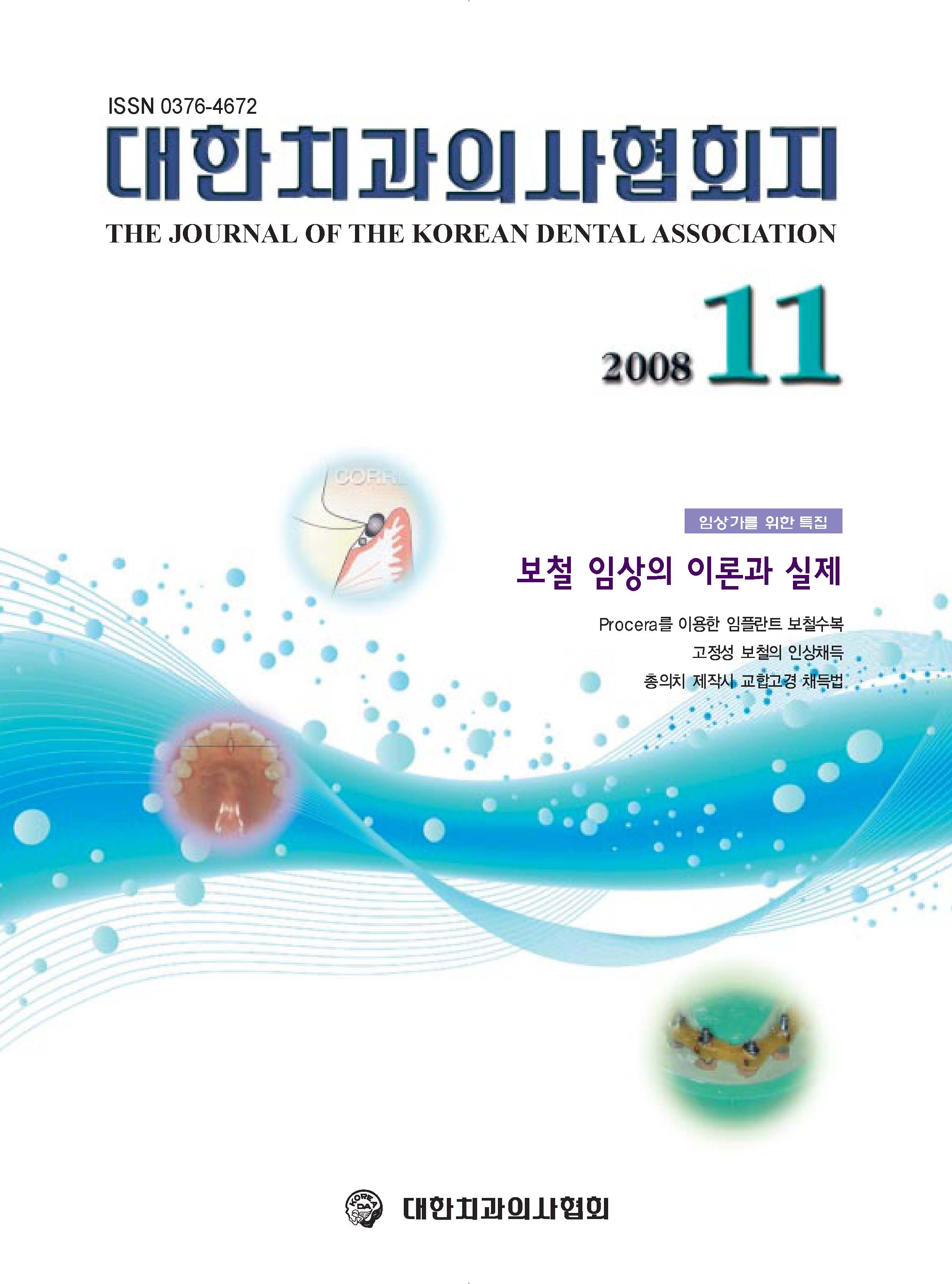 고정성 보철의 인상채득 The Journal of the Korean dental association