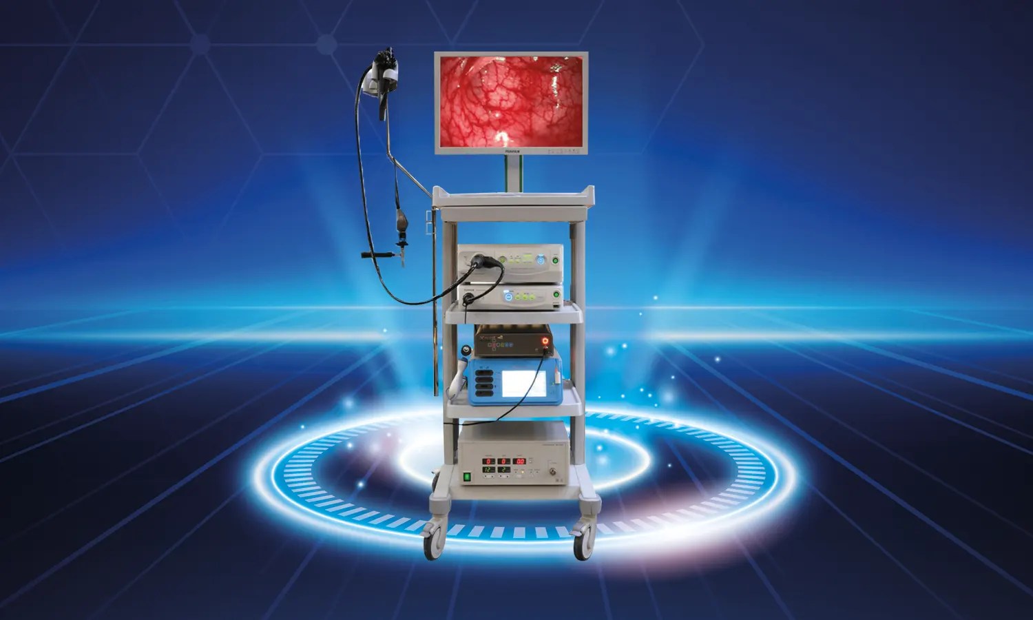 Endoscopy Koru International Medical Center Urological Cancers and