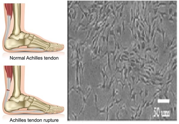 Culturing cells from the tendon to address tendon damage