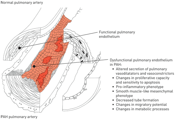 Culturing lung endothelial cells to target pulmonary hypertension and