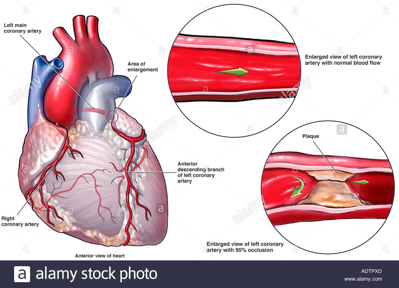 Kenali Sedini Mungkin Tentang Fatal Heart Attack — Kover Magazine