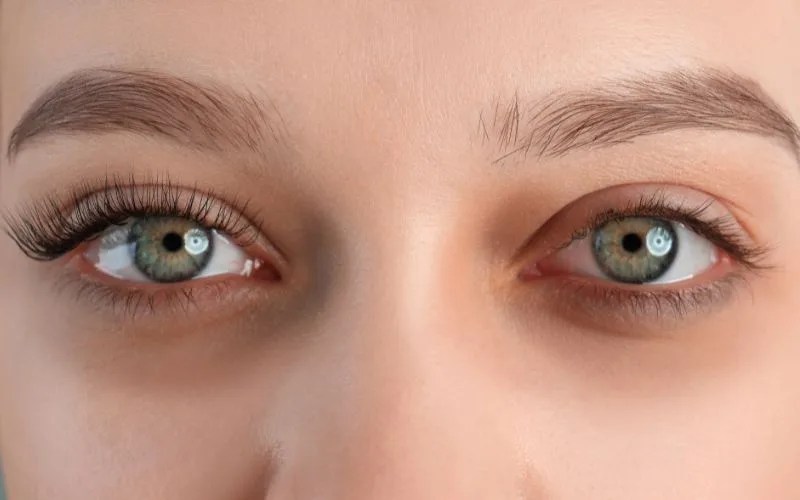 How to Remove Eye Bags NonSurgically Kowayo Aesthetic Clinic Singapore