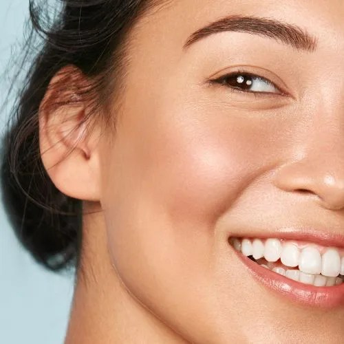 Laugh Line Filler Kowayo Aesthetic Clinic Singapore