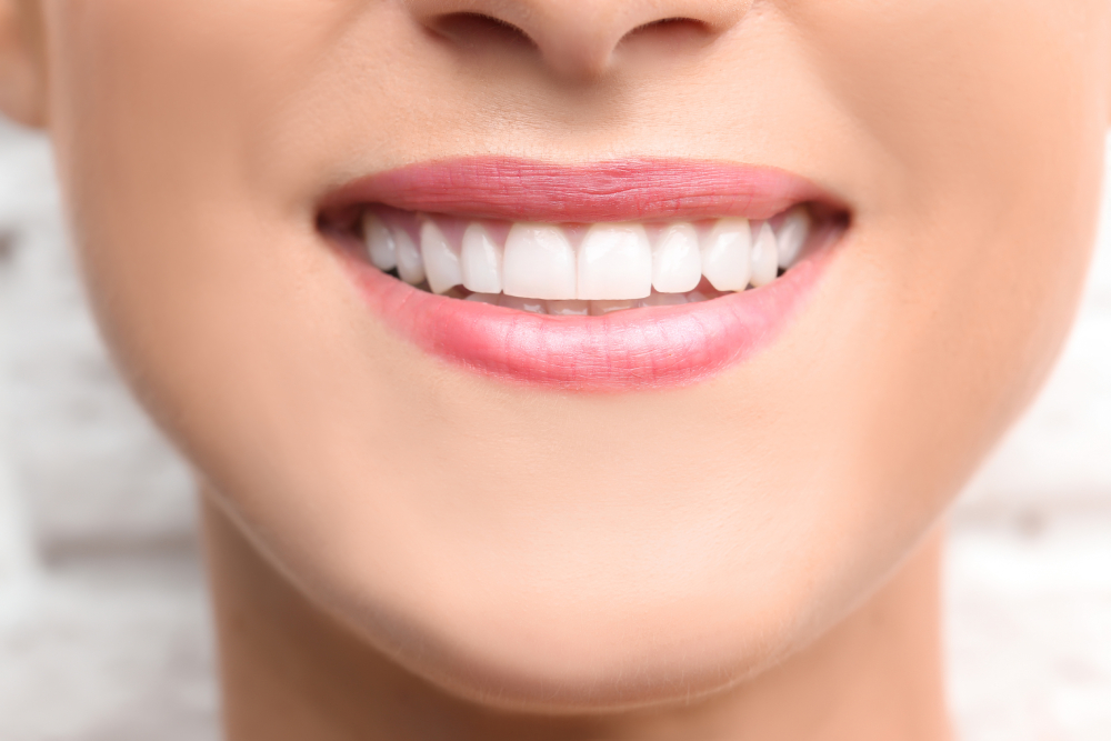 What Is Cosmetic Bonding and What Are Its Uses?