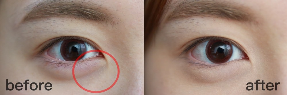 <實用Tips> KO 黑眼圈小技巧