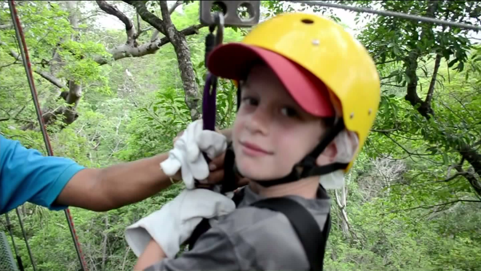 San Gabriel Mother Finds Botfly Larvae Peeking Out of Son’s Scalp After